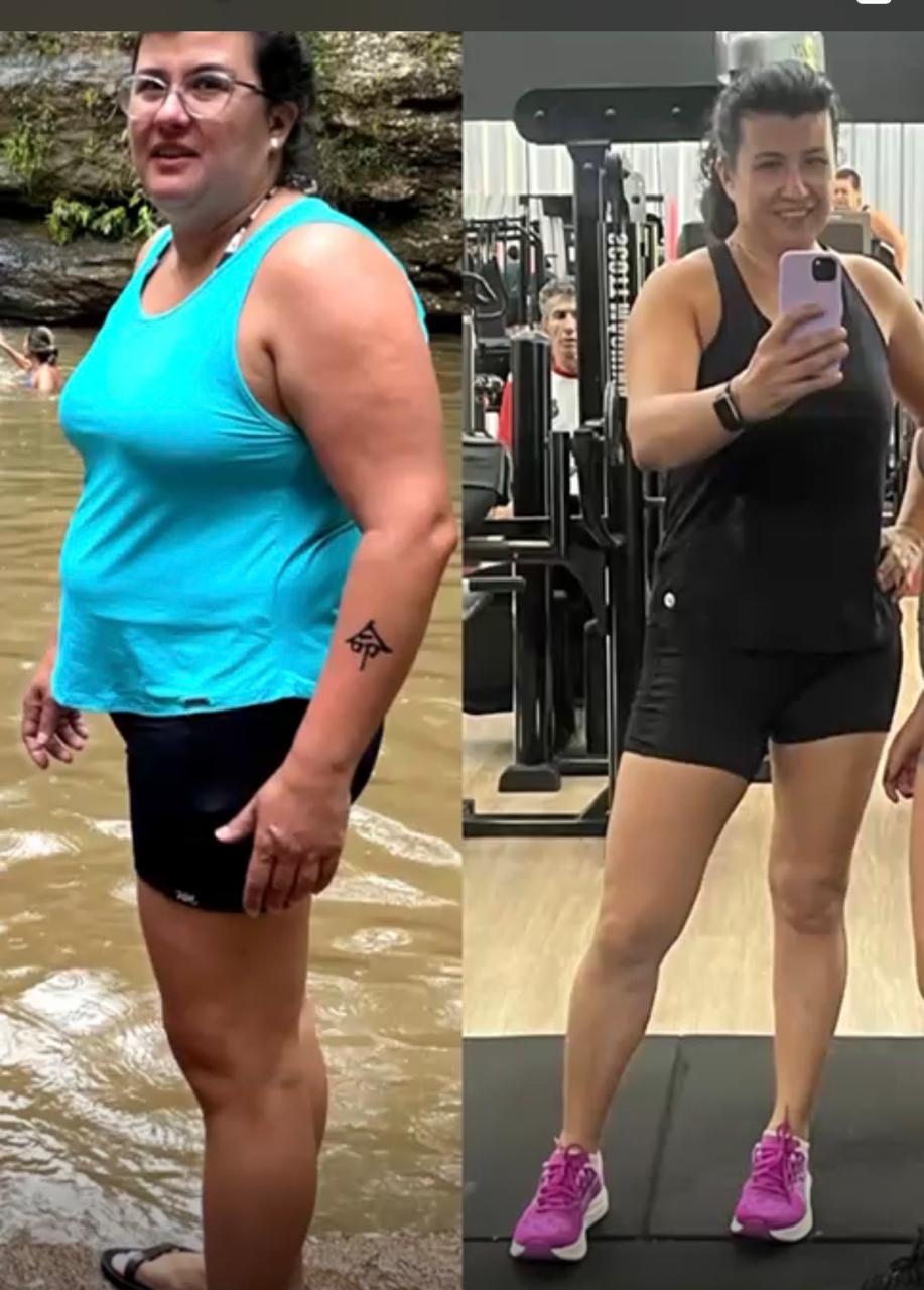 Alessandra antes e depois