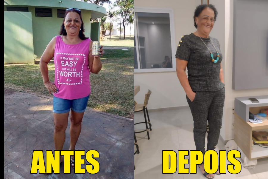 Jandira antes e depois