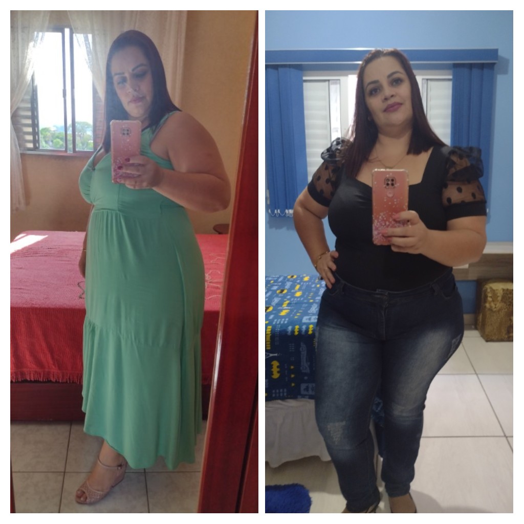 Meire antes e depois