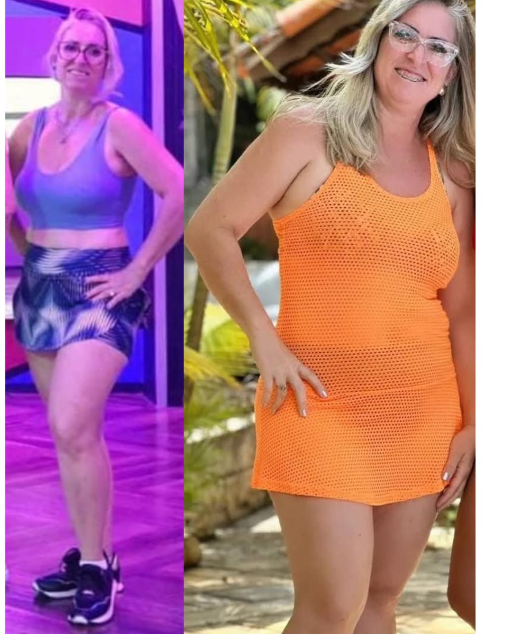 Fabiana antes e depois