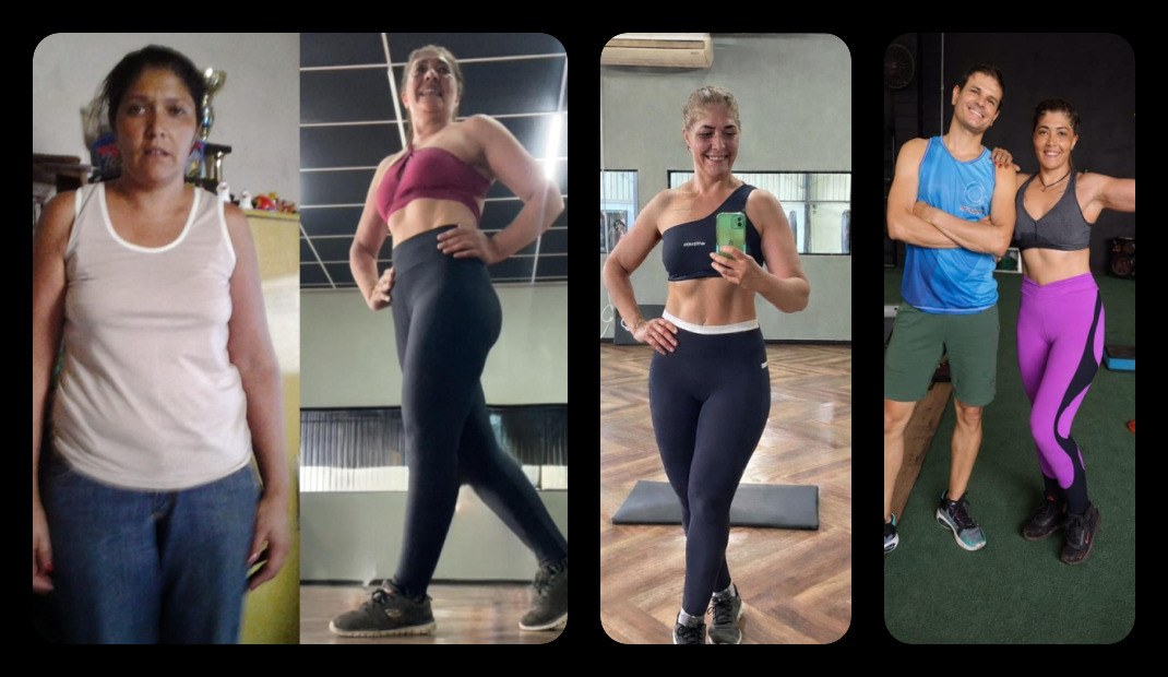 Gislaine antes e depois