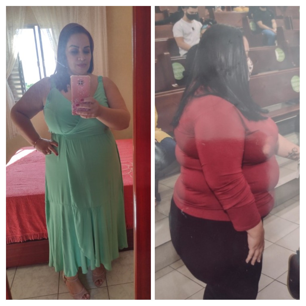 Meire antes e depois